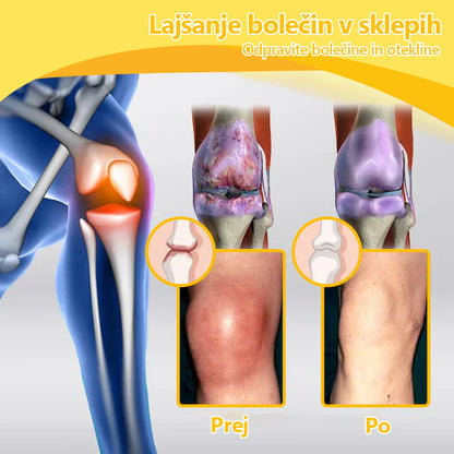 ArthroFree™ 🐝Zdravilna krema za artritis z čebeljim strupom in kurkumo - posebej oblikovana za zdravljenje ortopedskih bolezni in bolečin v sklepih 🍀