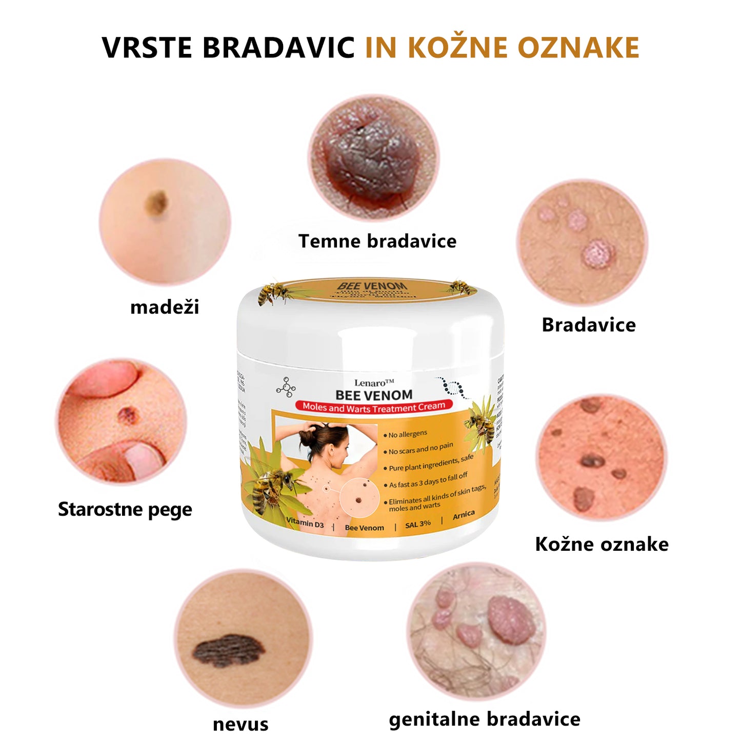 🐝🐝[🌟Uradna trgovina]🌟] Lenaro™ Krema za zdravljenje krtov in bradavic s čebeljim strupom (👨‍⚕AAD PRIPOROČA)