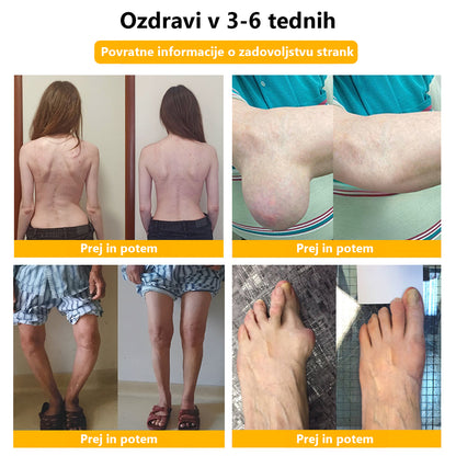 ArthroFree™ 🐝Zdravilna krema za artritis z čebeljim strupom in kurkumo - posebej oblikovana za zdravljenje ortopedskih bolezni in bolečin v sklepih 🍀