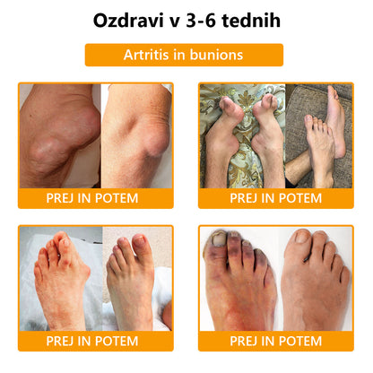 ArthroFree™ 🐝Zdravilna krema za artritis z čebeljim strupom in kurkumo - posebej oblikovana za zdravljenje ortopedskih bolezni in bolečin v sklepih 🍀