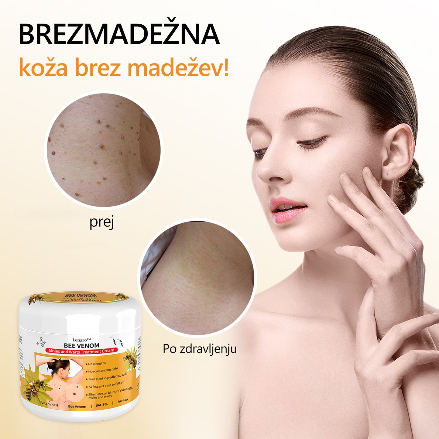 🐝🐝[🌟Uradna trgovina]🌟] Lenaro™ Krema za zdravljenje krtov in bradavic s čebeljim strupom (👨‍⚕AAD PRIPOROČA)