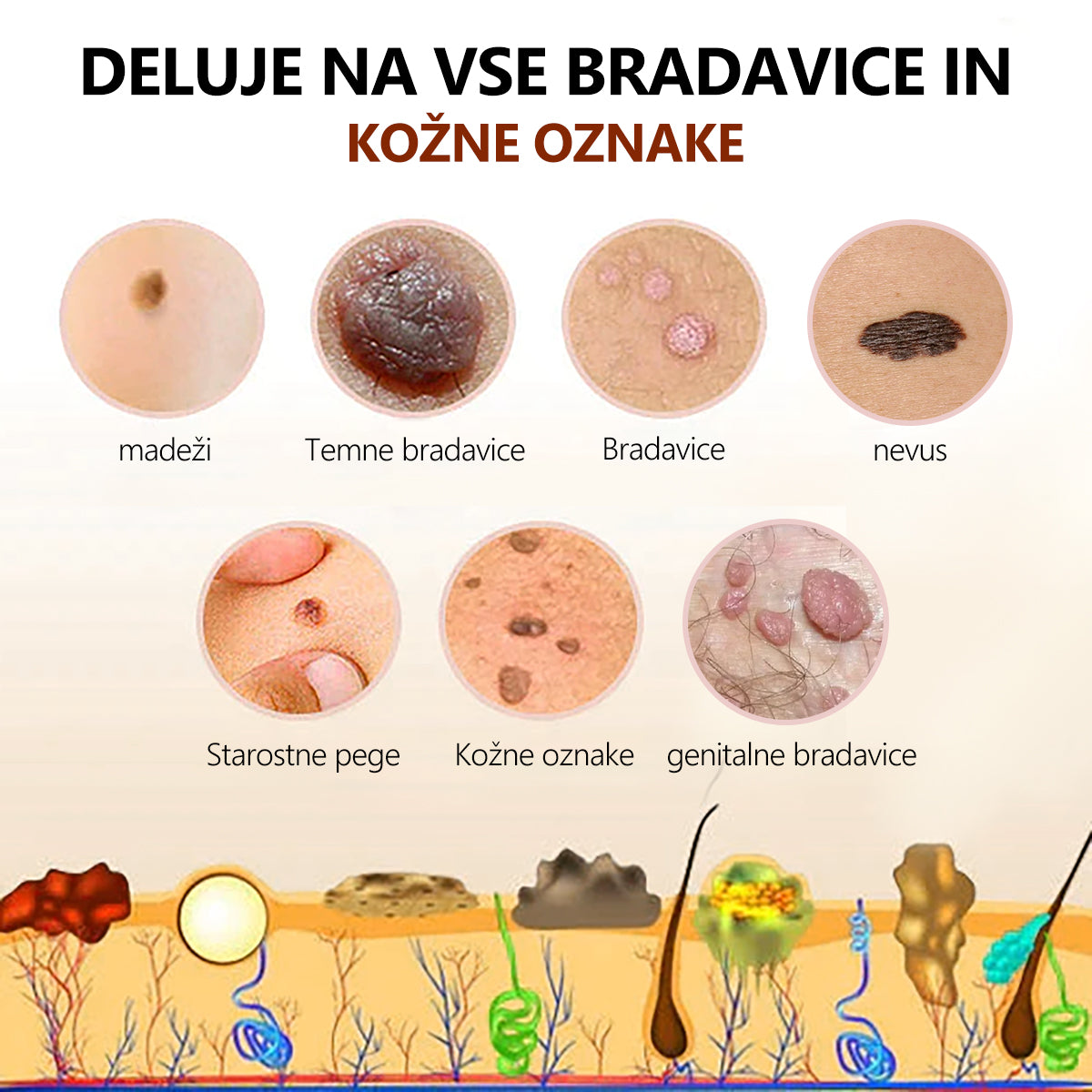 🐝🐝[🌟Uradna trgovina]🌟] Lenaro™ Krema za zdravljenje krtov in bradavic s čebeljim strupom (👨‍⚕AAD PRIPOROČA)