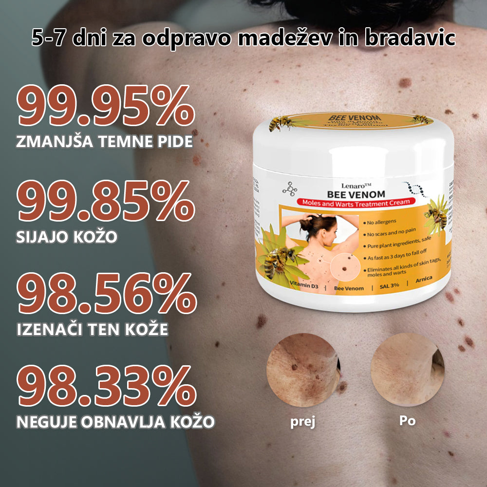 🐝🐝[🌟Uradna trgovina]🌟] Lenaro™ Krema za zdravljenje krtov in bradavic s čebeljim strupom (👨‍⚕AAD PRIPOROČA)