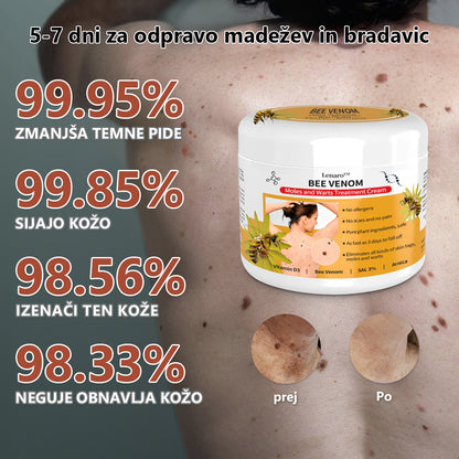 🐝🐝[🌟Uradna trgovina]🌟] Lenaro™ Krema za zdravljenje krtov in bradavic s čebeljim strupom (👨‍⚕AAD PRIPOROČA)