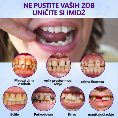 Uživajte v nasmehih in hrani🎁Bikenda™ Set silikonsko oblazinjenih zobnih protez🚀(80 % popusta za omejen čas - zadnjih 30 minut)